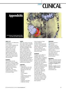 FACTS  CLINICAL Appendicitis­