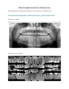 Photo Examples for the Five Detailed Cases Each applicant must submit the following for each of the five (5) detailed cases. Pre-treatment radiographs, either panoramic or full mouth series. Panoramic example