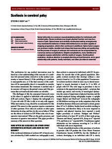 DEVELOPMENTAL MEDICINE & CHILD NEUROLOGY  REVIEW Scoliosis in cerebral palsy STEVEN E KOOP