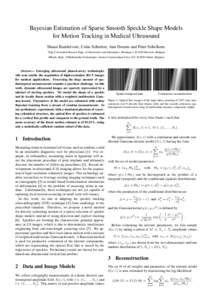 Econometrics / Expectation–maximization algorithm / Missing data / Gaussian function / Mixture model / Autoregressive conditional heteroskedasticity / Speckle tracking echocardiography / Maximum likelihood / Multivariate normal distribution / Statistics / Estimation theory / Statistical models