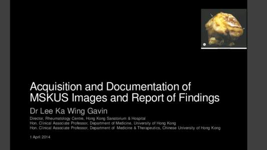 Acquisition and Documentation of MSKUS Images and Report of Findings Dr Lee Ka Wing Gavin Director, Rheumatology Centre, Hong Kong Sanatorium & Hospital Hon. Clinical Associate Professor, Department of Medicine, Universi
