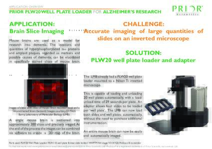 APPLICATION OVERVIEW  PRIOR PLW20 WELL PLATE LOADER FOR ALZHEIMER’S RESEARCH APPLICATION: Brain Slice Imaging