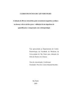 CLERIO FRANCISCO DE AZEVEDO FILHO  Avaliação da fibrose miocárdica pela ressonância magnética cardíaca na doença valvar aórtica grave: validação de um algoritmo de quantificação e comparação com a histopato