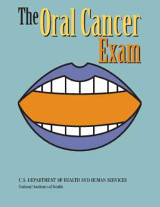 U.S. DEPARTMENT OF HEALTH AND HUMAN SERVICES National Institutes of Health An oral cancer exam is painless and quick — it takes only a few minutes. Your regular dental check-up is an excellent opportunity to have the 