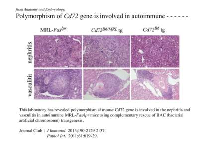 from Anatomy and Embryology,  Polymorphism of Cd72 gene is involved in autoimmune - - - - - - 図