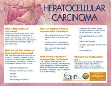 What is Hepatocellular Carcinoma? Hepatocellular carcinoma (HCC) is the most common form of liver cancer in adults. It accounts for about 3 out of 4 cancers that start in the liver. HCC begins