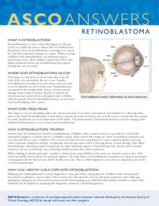 ASCO ANSWER S  R E T I N O B L A S TO M A Illustration by Robert Morreale/Visual Explanations, LLC. © 2004 American Society of Clinical Oncology.  WHAT IS RETINOBLASTOMA?