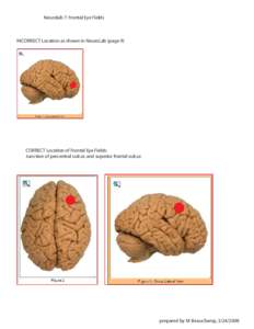 Neurolab 7: Frontal Eye Fields  INCORRECT Location as shown in NeuroLab (page 9) CORRECT Location of Frontal Eye Fields: Junction of precentral sulcus and superior frontal sulcus