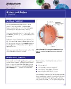 [removed]floaters and flashes a closer look  What are floaters?