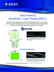 Medical equipment / Laser medicine / Acronyms / Laser / Photonics / Optical coherence tomography / Macular edema / Retina / Medicine / Optics / Physics