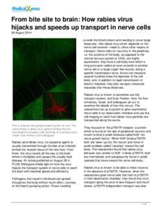 From bite site to brain: How rabies virus hijacks and speeds up transport in nerve cells