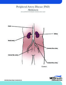 Peripheral Artery Disease (PAD) Abdomen www.mcg.edu/SOM/medicine/Cardiology/patient_education/pad_abdomen_sheet.pdf Aorta