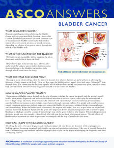 BL ADDER CANCER Illustration by Robert Morreale/Visual Explanations, LLC. © 2004 American Society of Clinical Oncology. WHAT IS BLADDER CANCER? Bladder cancer begins when cells lining the bladder change and grow uncontr