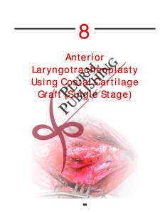 8 Anterior Laryngotracheoplasty Using Costal Cartilage Graft (Single Stage)