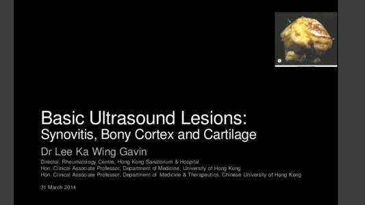 Basic Ultrasound Lesions: Synovitis, Bony Cortex and Cartilage Dr Lee Ka Wing Gavin Director, Rheumatology Centre, Hong Kong Sanatorium & Hospital Hon. Clinical Associate Professor, Department of Medicine, University of 