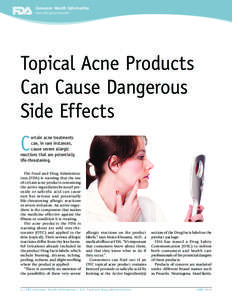 Consumer Health Information www.fda.gov/consumer Topical Acne Products Can Cause Dangerous Side Effects