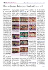 2b  hygiene tribune Dental tribune Middle East & Africa Edition | May-June 2015