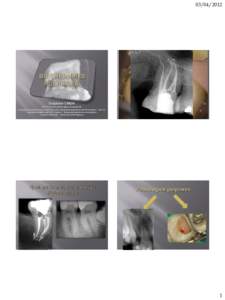 Stéphane SIMON MCU PH en Sciences Biologiques et endodontie Responsable du Diplôme Universitaire Européen d’Endodontologie (Université Paris Diderot – Paris 7) Laboratoire INSERM UMRS 872 – Equipe 5