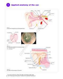 1  Applied anatomy of the ear Malleus