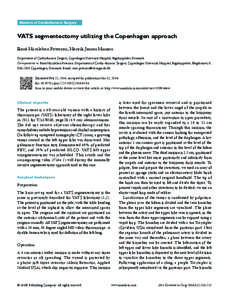 Masters of Cardiothoracic Surgery  VATS segmentectomy utilizing the Copenhagen approach