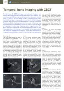 Ear / Auditory system / Cholesteatoma / Mastoid part of the temporal bone / Temporal bone / Aditus to mastoid antrum / Otitis media / X-ray computed tomography / Radiology / Medicine / Human anatomy / Anatomy