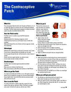 The Contraceptive Patch What it is Where to put it