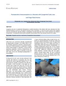 Leily et al, Congenital cutis laxa, hiatus hernia, and postoperative intussusception  C ASE R EPORT