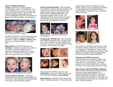 DiGeorge syndrome / Sense / Treacher Collins syndrome / Stickler syndrome / Health / Syndromes / CHARGE syndrome