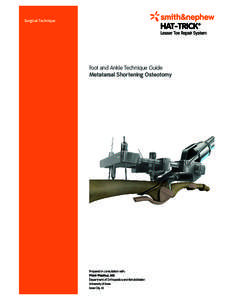 Surgical Technique  	 Foot and Ankle Technique Guide Metatarsal Shortening Osteotomy
