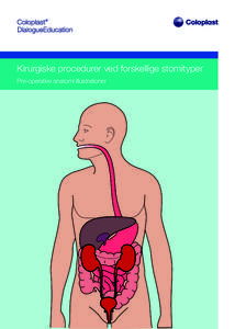 Kirurgiske procedurer ved forskellige stomityper Pre-operative anatomi illustrationer Sådan konstrueres en stomi