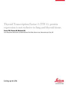 Thyroid Transcription Factor-1 (TTF‑1): protein expression is not exclusive to lung and thyroid tissue. Scorer PW, Pinkney M, McIntosh GG. Leica Biosystems Newcastle Ltd, Balliol Business Park West, Benton Lane, Newcas