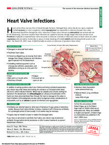 The Journal of the American Medical Association  Heart Valve Infections H