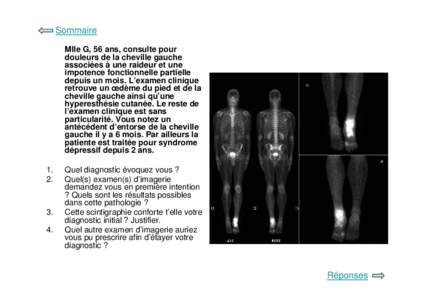 Sommaire Mlle G, 56 ans, consulte pour douleurs de la cheville gauche associées à une raideur et une impotence fonctionnelle partielle depuis un mois. L’examen clinique