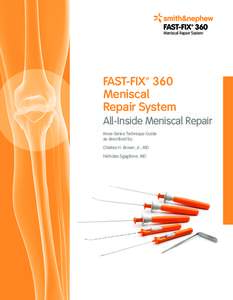 FAST-FIX™ 360 Meniscal Repair System FAST-FIX™ 360 Meniscal Repair System