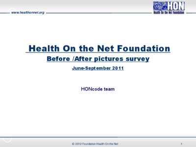 www.healthonnet.org  Health On the Net Foundation Before /After pictures survey June-September 2011