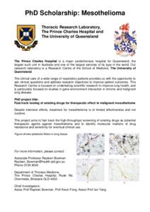 PhD Scholarship: Mesothelioma Thoracic Research Laboratory, The Prince Charles Hospital and The University of Queensland  The Prince Charles Hospital is a major cardiothoracic hospital for Queensland, the