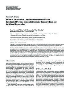Effect of Intraocular Lens Diameter Implanted in Enucleated Porcine Eye on Intraocular Pressure Induced by Scleral Depression