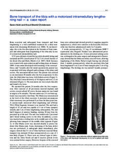 Acta Orthopaedica 2014; 85 (2): 211–[removed]