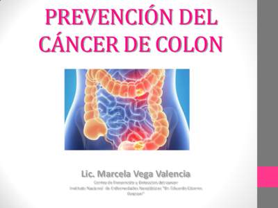 PREVENCIÓN DEL CÁNCER DE COLON Lic. Marcela Vega Valencia Centro de Prevención y Deteccion del cancer Instituto Nacional de Enfermedades Neoplásicas “Dr. Eduardo Cáceres