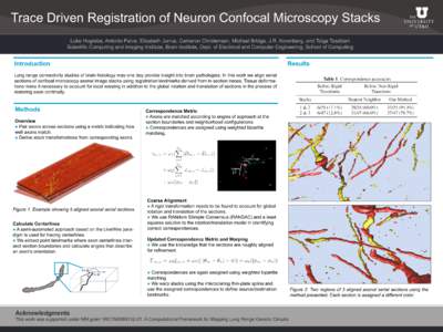 Trace Driven Registration of Neuron Confocal Microscopy Stacks Luke Hogrebe, Antonio Paiva, Elizabeth Jurrus, Cameron Christensen, Michael Bridge, J.R. Korenberg, and Tolga Tasdizen Scientific Computing and Imaging Insti