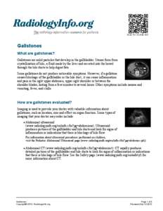 Scan for mobile link.  Gallstones What are gallstones? Gallstones are solid particles that develop in the gallbladder. Stones form from crystallization of bile, a fluid made by the liver and secreted into the bowel