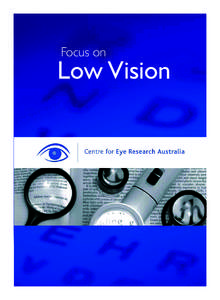 Focus on  Low Vision Acknowledgements The authors would like to acknowledge the following members of the Centre for