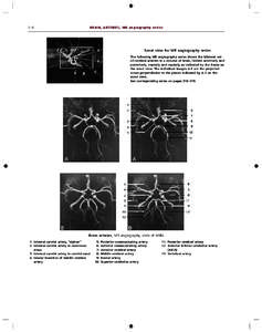 Internal carotid artery / Circle of Willis / Basilar artery / Posterior communicating artery / Anterior cerebral artery / Middle cerebral artery / Posterior cerebral artery / Common carotid artery / Cerebral arteries / Angiology / Human anatomy / Medicine