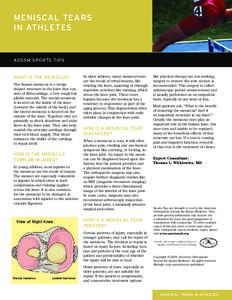 MENISCAL TEARS IN ATHLETES AOSSM SPORTS TIPS  WHAT IS THE MENISCUS?