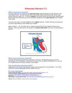 Pulmonary Stenosis (PS) What is pulmonary stenosis? Pulmonary stenosis is a narrowing of the pulmonary valve (opening between the right ventricle of the heart and the lungs). Normally, the pulmonary valve allows oxygen-p