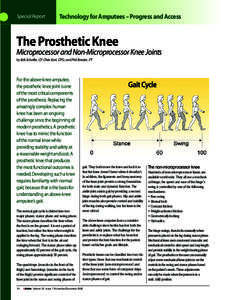 Special Report  Technology for Amputees – Progress and Access The Prosthetic Knee