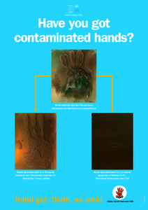 Have you got contaminated hands? Hands contaminated with Pseudomonas aeruginosa and Staphylococcus saprophyticus