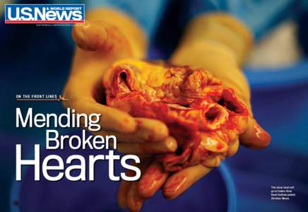 Aortic valve replacement / Heart valve repair / Cardiopulmonary bypass / Heart transplantation / Aortic valve / Christiaan Barnard / Heart valve / Heart–lung transplant / Mitral valve / Medicine / Cardiac surgery / Mitral valve repair