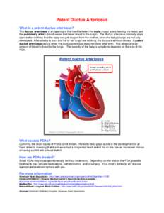 Patent Ductus Arteriosus What is a patent ductus arteriosus? The ductus arteriosus is an opening in the heart between the aorta (major artery leaving the heart) and the pulmonary artery (blood vessel that takes blood to 