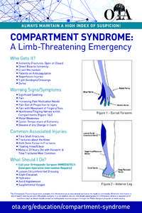 ALWAYS MAINTAIN A HIGH INDEX OF SUSPICION!  COMPARTMENT SYNDROME: A Limb-Threatening Emergency Who Gets It? Extremity Fractures: Open or Closed